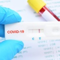 Visualizza la notizia: Covid - In Sardegna sufficiente un test antigenico per certificare il contagio 