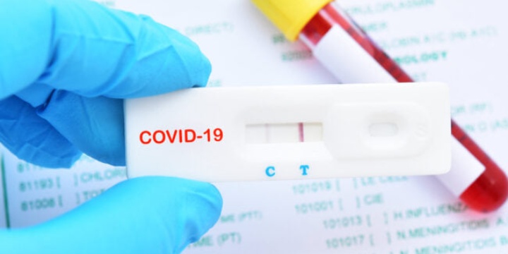 Covid - In Sardegna sufficiente un test antigenico per certificare il contagio 